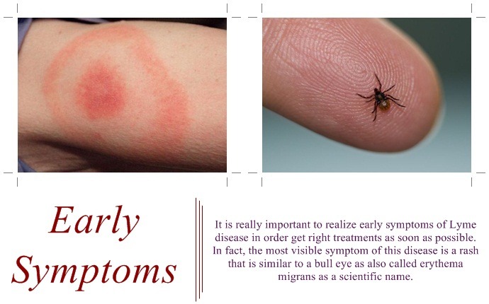 symptoms of lyme disease - early symptoms