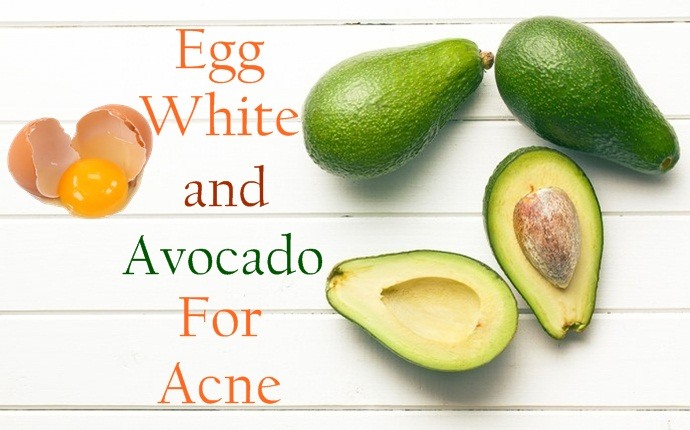 avocado for acne - egg white and avocado for acne