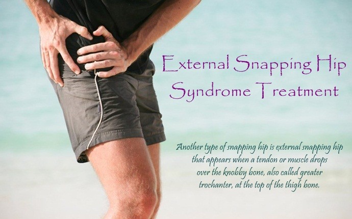 snapping hip syndrome treatment - external snapping hip syndrome treatment