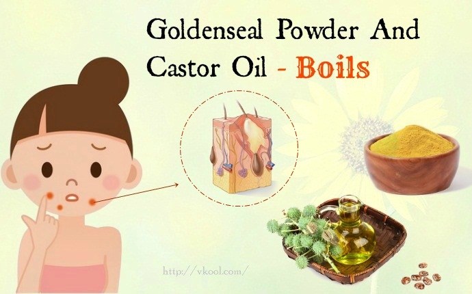 castor oil for boils - goldenseal powder and castor oil