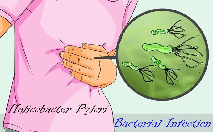 causes of peptic ulcer - helicobacter pylori bacterial infection