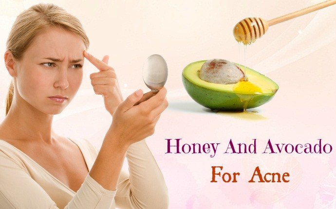 avocado for acne - honey and avocado for acne