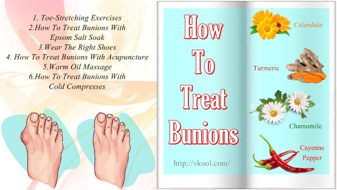 how to treat bunions on feet