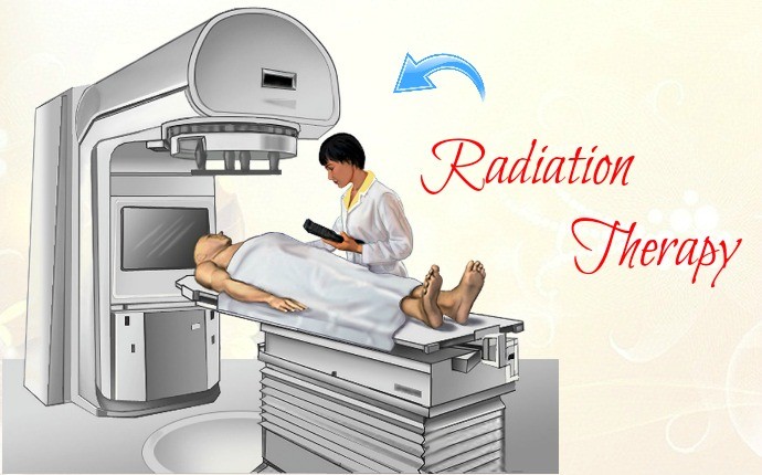 treatments for cushing's syndrome - radiation therapy