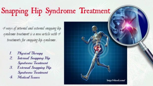 external snapping hip syndrome treatment