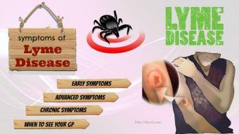 signs and symptoms of Lyme disease