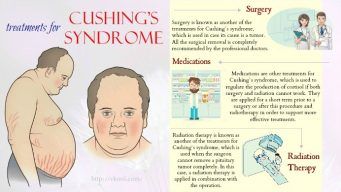 treatments for Cushing's syndrome in humans