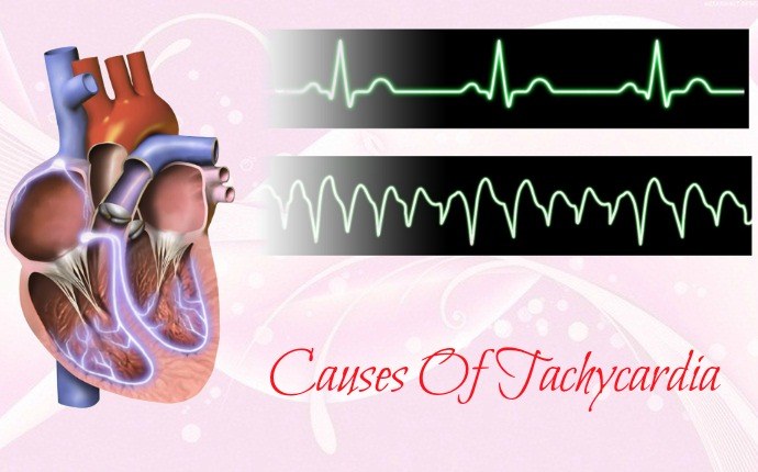 symptoms of tachycardia - causes of tachycardia