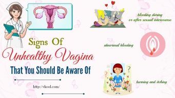 unhealthy vagina