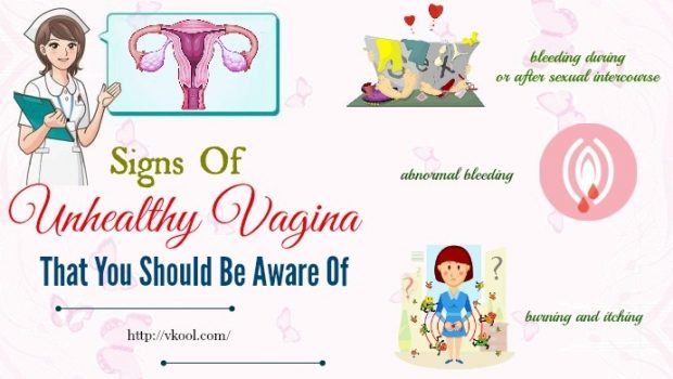 unhealthy vagina