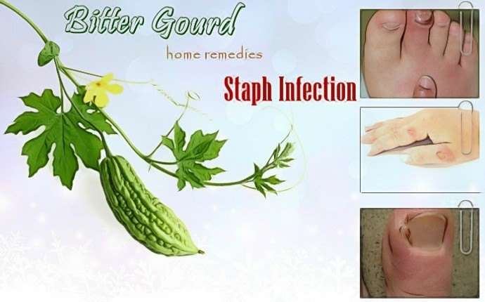 home remedies for staph infection - bitter gourd