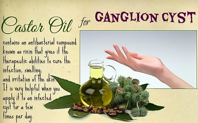 how to treat a ganglion cyst - castor oil