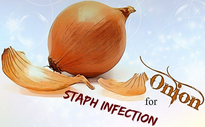 home remedies for staph infection - onion