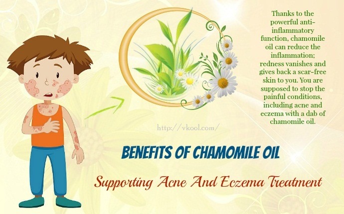 benefits of chamomile oil - supporting acne and eczema treatment