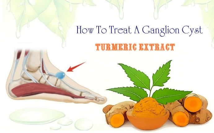 how to treat a ganglion cyst - turmeric extract