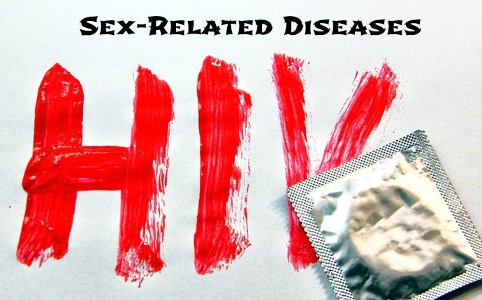 sex-related diseases - hiv