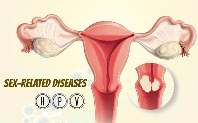 sex-related diseases - hpv