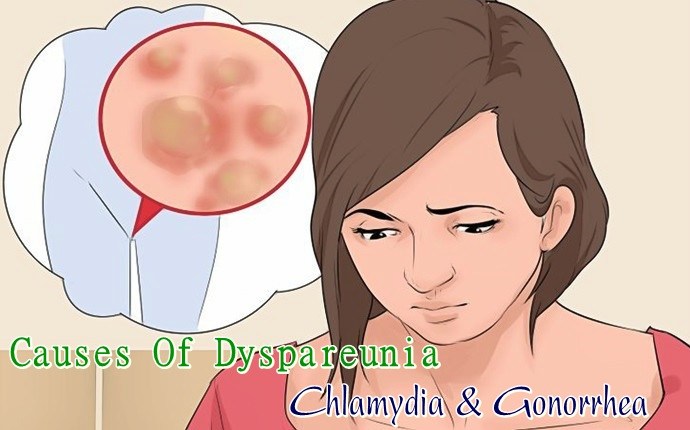 common causes of dyspareunia - chlamydia & gonorrhea