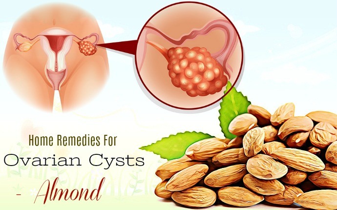 home remedies for ovarian cysts - almond