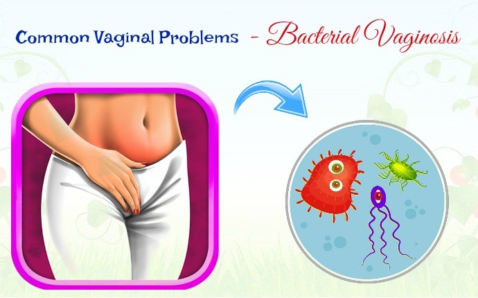 common vaginal problems - bacterial vaginosis