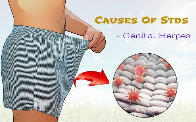 causes of stds - genital herpes