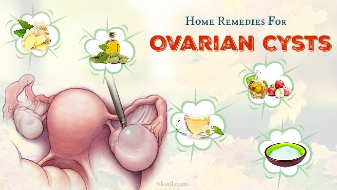ovarian cysts