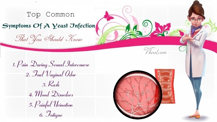 common symptoms of a yeast infection