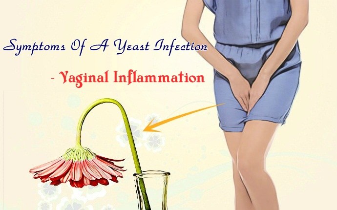 symptoms of a yeast infection - vaginal inflammation