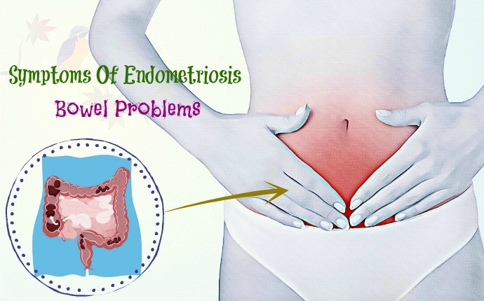 symptoms of endometriosis - bowel problems