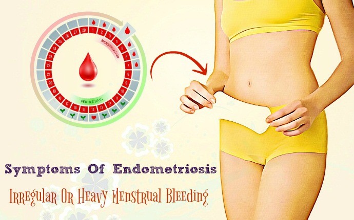 symptoms of endometriosis - irregular or heavy menstrual bleeding