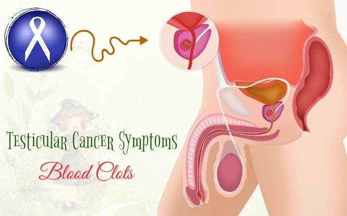 testicular cancer symptoms - blood clots